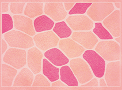 筋線維の断面図