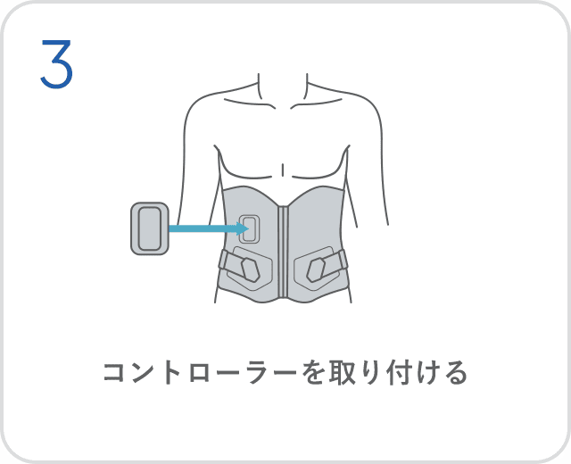 コントローラーを取り付ける