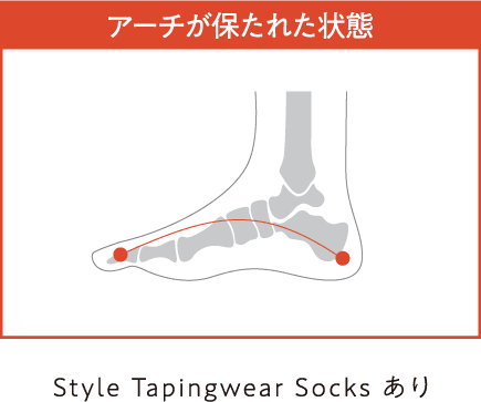 アーチが保たれた状態